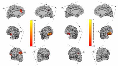 Exploring the Neural Structures Underlying the Procedural Memory Network as Predictors of Language Ability in Children and Adolescents With Autism Spectrum Disorder and Attention Deficit Hyperactivity Disorder